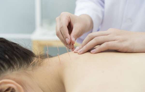 Acupuncture Treatment For Pain NYC